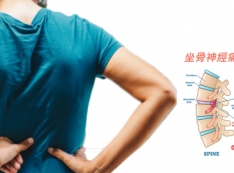 【推薦】消滅坐骨神經痛不必挨刀! 勤練「3式舒緩妙招」讓筋骨軟回來